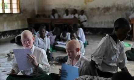 Mozambique : Un homme qui voulait vendre ses enfants albinos arrêté.