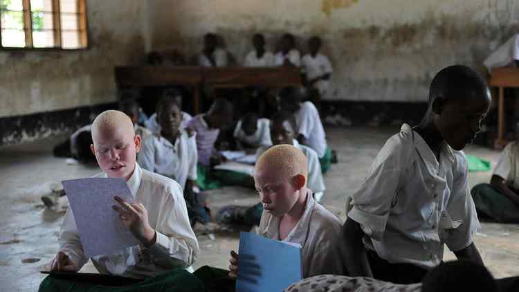 Mozambique : Un homme qui voulait vendre ses enfants albinos arrêté.